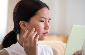 Bubble Skincare Acne Spot Treatment Zapped My Pimples in Two Days