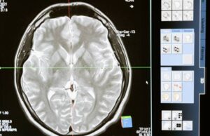 Why The Smart Money is Going into Thought Control