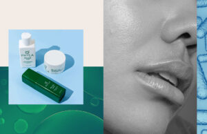 3 Brands That Use Good Bacteria To Treat Acne