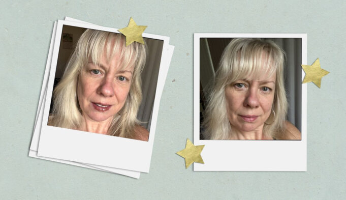 The Filorga NCEF Shot Reduces Wrinkles in 10 Days