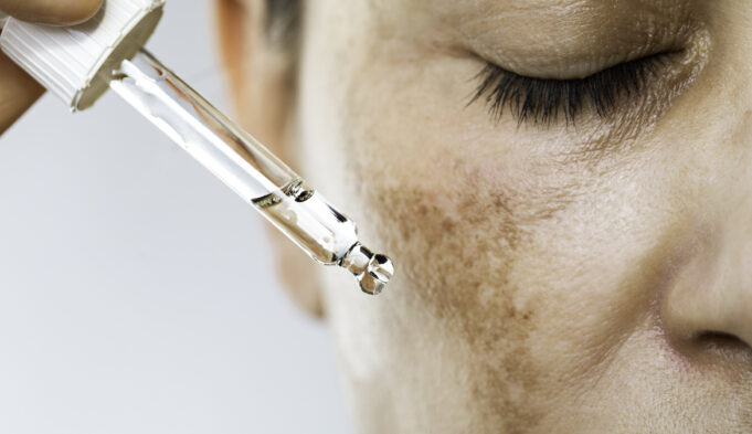 4 New Hyperpigmentation Treatments Worth the Money|Well+Good