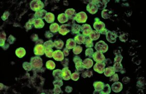 CDC Rules Out Deadly ‘Brain-Eating’ Amoeba in Mysterious Arizona Infection | The Gateway Pundit