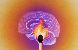 How Dr. Sasha Hamdani Advises Handling Burnout