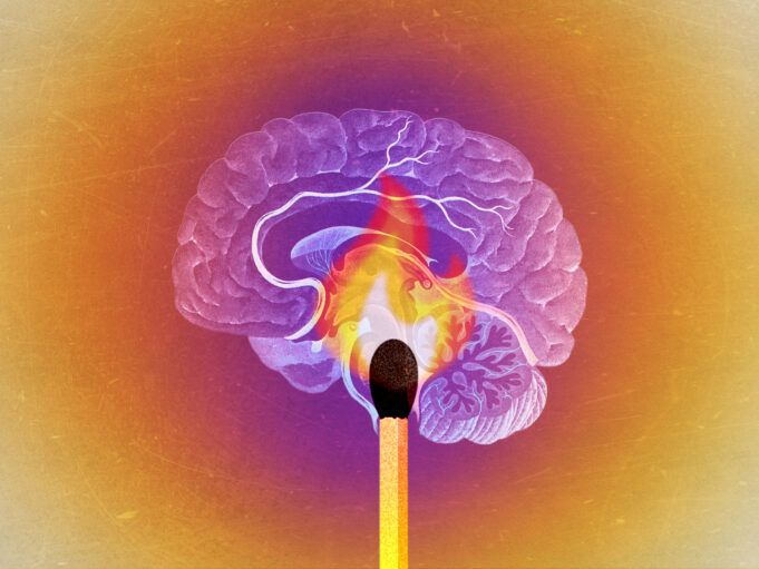 How Dr. Sasha Hamdani Advises Handling Burnout