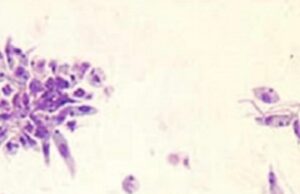 Skin-Disfiguring Parasite That Plagues Middle East, Latin America and Asia Now Detected in US, CDC Warns | The Gateway Pundit