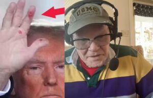 Left-Wing Media Freaks Over ‘Mysterious Red Marks’ on Trump’s Hand – Dem Strategist James Carville Claims it Looks Like Syphilis (VIDEO) | The Gateway Pundit