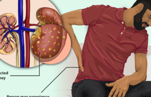 Racial Preferences in Treating Kidney Disease | The Gateway Pundit
