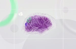 Elemind: Wearable AI offers ‘electric medicine’ via brain stimulation