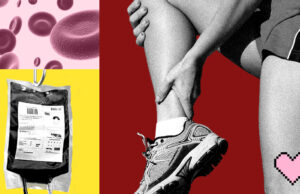 My Health Journey With Homozygous Factor V Leiden