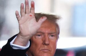 Trump Responds to Rumors About Red Marks on His Hand | The Gateway Pundit