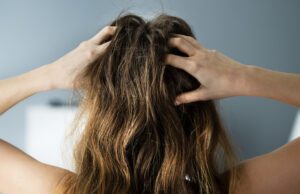 The 9 Best Home Remedies for an Itchy Scalp