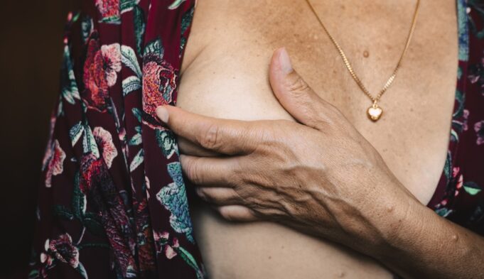 Odds of Having 2 Types of Breast Cancer at the Same Time
