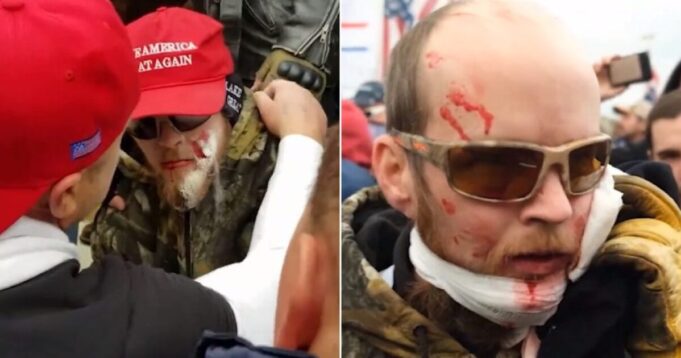 Here Are the Seven Men Shot in the Head by Capitol Police on January 6, 2021 Without Warning – VIDEO and PHOTOS | The Gateway Pundit