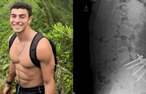 Suspect Luigi Mangione Reportedly Battled Severe Back Injury Before Disappearing for Six Months — Family Breaks Silence on His Arrest | The Gateway Pundit