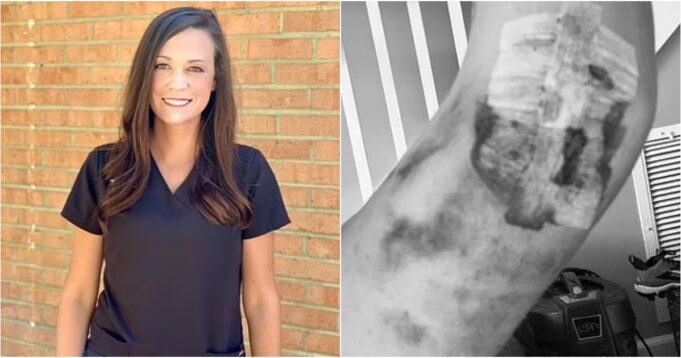 Betrayed by the Science: Doctors Confirm COVID Shot Linked to Nursing Home Director’s Devastating Bone-Rotting Condition | The Gateway Pundit