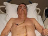 Fears Grow for Brazil’s Jair Bolsonaro as Doctors Report Worsening Condition Six Years After Leftist Assassination Attempt | The Gateway Pundit