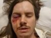 Trump-Hating Agitator Shot in the Eye After Thugs Violently Assault Police Officers During “No Kings” Riot in Los Angeles | The Gateway Pundit