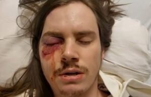 Trump-Hating Agitator Shot in the Eye After Thugs Violently Assault Police Officers During “No Kings” Riot in Los Angeles | The Gateway Pundit