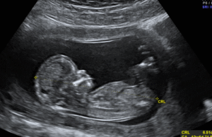 Texas Father Sues California Doctor for Wrongful Death of his Unborn Children in Landmark Abortion Pill Case | The Gateway Pundit