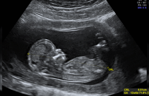 Priests for Life: Call on the FDA to End Death by Chemical Abortion | The Gateway Pundit