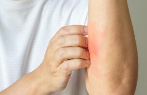 A Promising New Treatment for the 84 Million Americans Suffering from Skin Conditions | The Gateway Pundit